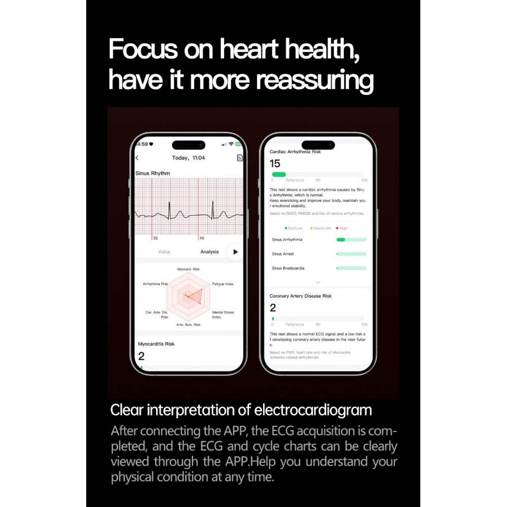 ET475 Смарт Часовник с AMOLED Дисплей и ECG – Bluetooth Обаждания, NFC, Кожена Каишка